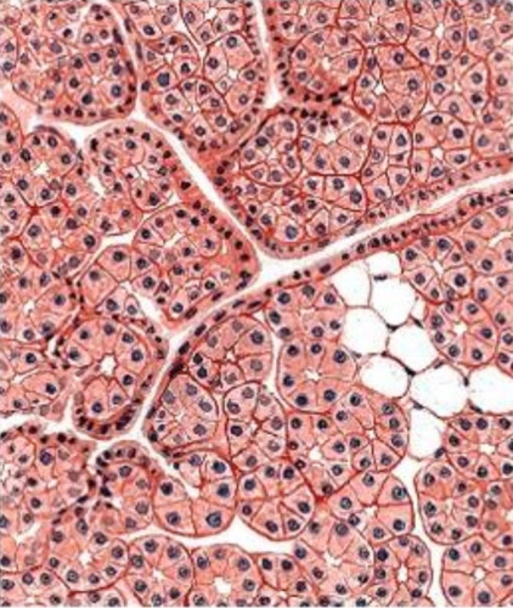 <p>what gland is this from? how do you know?</p>