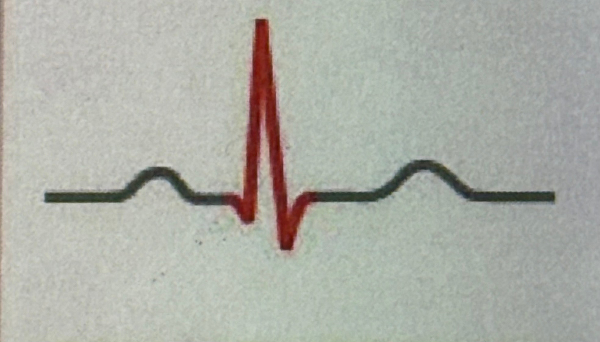 <p>pumping blood to body and lungs ventricles contracting out</p>