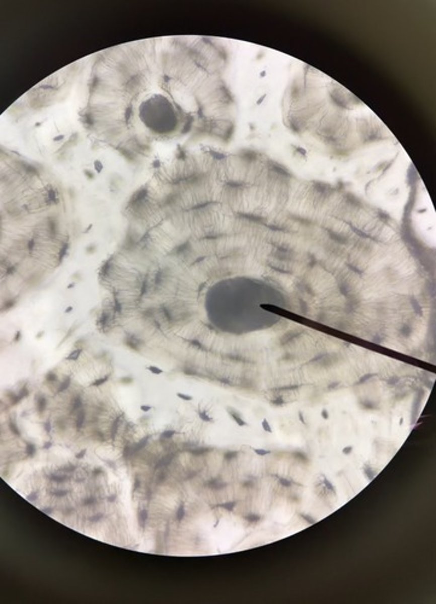<p>1. What is one entire circular unit of compact bone seen here?</p><p>2. What structure is the pointer on?</p><p>3. What are the numerous smaller black "holes" seen in the slide?</p><p>4. what are the black lines or "cracks" seen in this slide?</p>