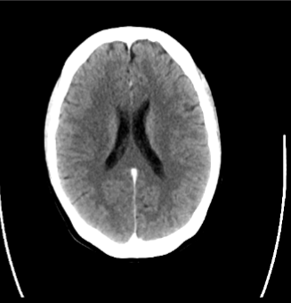 <p>What imaging modality is seen here?</p>