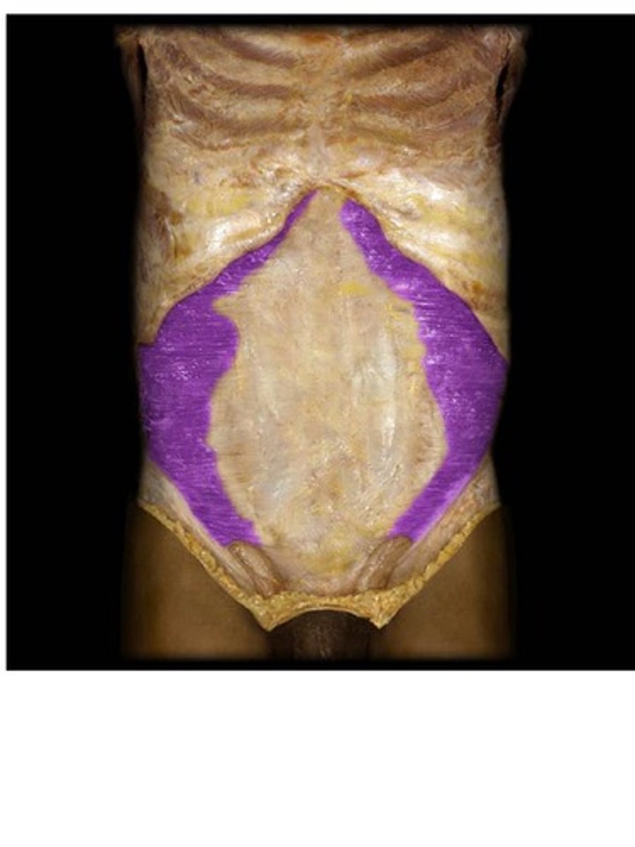 <p>Transverse Abdominis Origin</p>