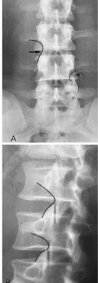 <p>What line of mensuration is this?</p>