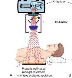 <p>Is this image good collimation or bad</p>