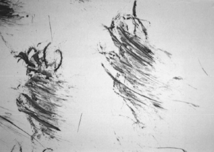 <p>What bloodstain pattern is this?</p>