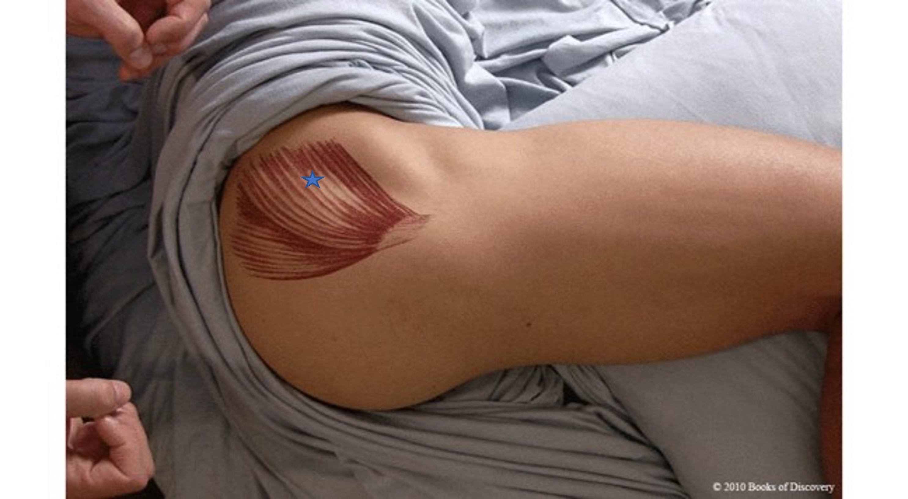 <p><span>From the list of muscles and actions below, identify the "starred" muscle and its primary actions. NOTE: There are several primary actions...do not choose actions where the muscle assists.</span></p><p><span><span>A) Extend hip</span></span></p><p><span><span>B) Gluteus minimus</span></span></p><p><span><span>C) Gluteus maximus</span></span></p><p><span><span>D) Anterior fibers of gluteus medius</span></span></p><p><span><span>E) Medially rotate hip</span></span></p><p><span><span>F) Posterior fibers of gluteus medius</span></span></p><p><span><span>G) Adduct hip</span></span></p><p><span><span>H) Laterally rotate hip</span></span></p><p><span><span>I) Abduct hip</span></span></p><p><span><span>J) Flex the hip</span></span></p>