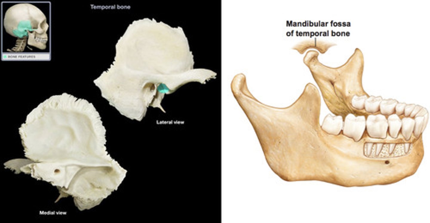 <p>temporal bone</p>