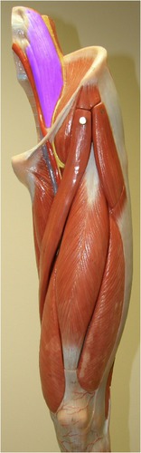 <p>Identify the muscle.</p>