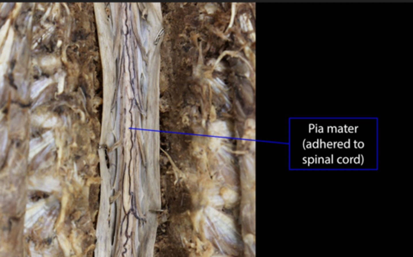 <p>Innermost layer of the meninges</p><p>- denticulate ligament</p><p>- filum terminale</p>