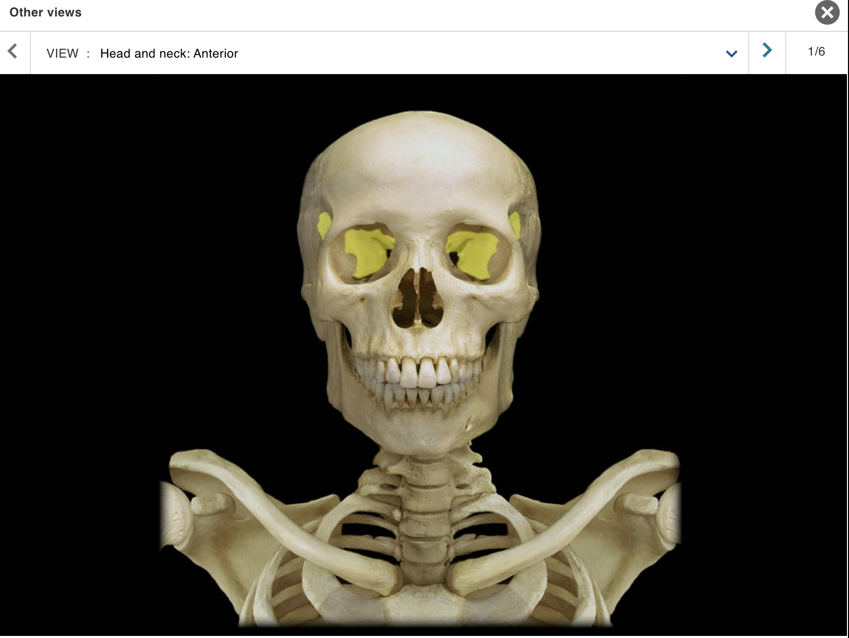 <p>Location:</p><p class="p1">• Skull</p><p class="p1">Description:</p><ul><li><p>﻿﻿Unpaired, irregular-shaped bone</p></li><li><p>﻿﻿Shape resembles a butterfly</p></li><li><p>﻿﻿Consists of body, and greater and lesser wings</p></li></ul><p class="p1">Comment:</p><p class="p1">• Contributes to middle cranial fossa, nasal cavities, orbits, and lateral skull (temples)</p><p class="p1">• Contains sella turcica ("Turkish saddle"), sphenoidal air sinus, and many foramina</p>