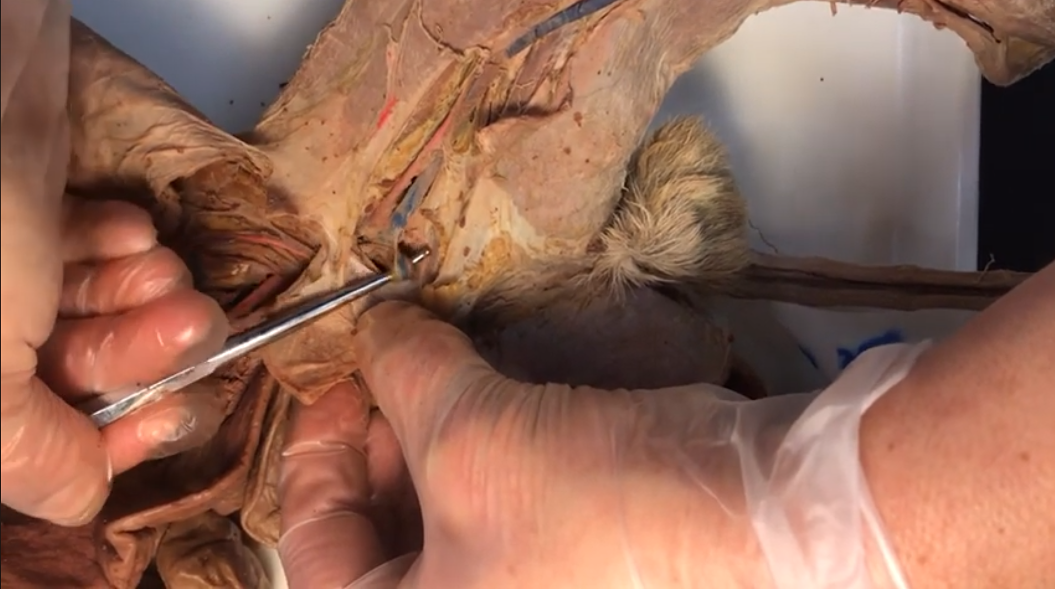 <p>What artery is this</p>