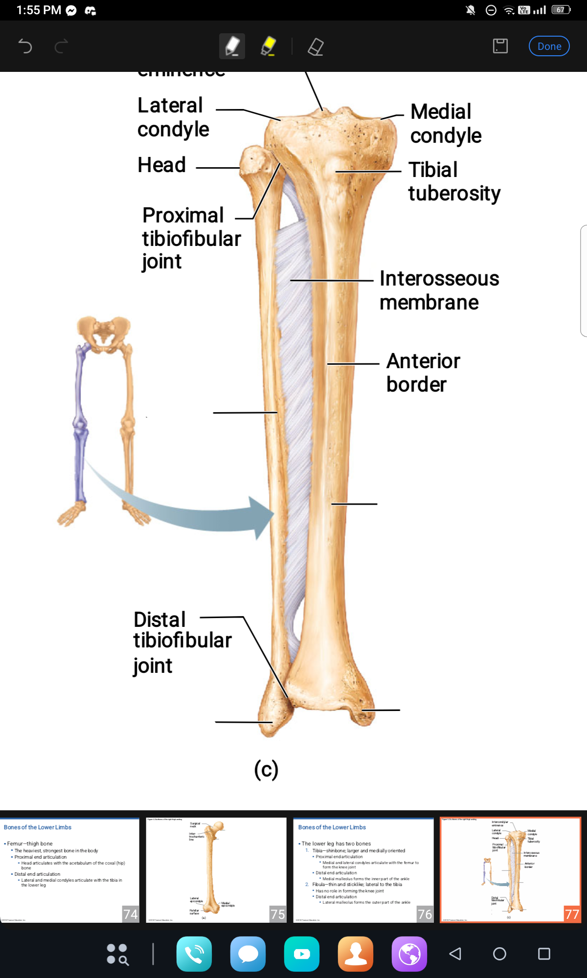 <p>LOWER LEG BONES </p>