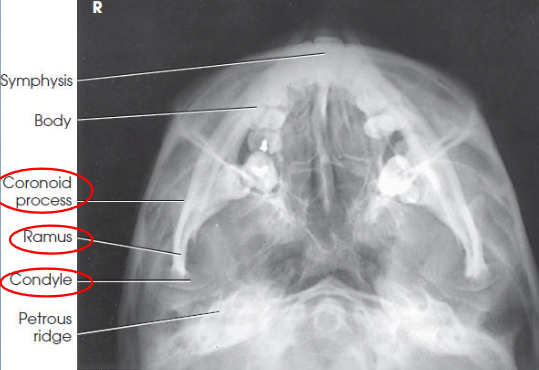 <ul><li><p>coronoid and condyloid processes of the rami</p></li><li><p>no rotation or tilt</p><ul><li><p>equidistant lateral border of skull and mandible</p></li><li><p>MSP of head aligned to long axis of collimated field</p></li></ul></li><li><p>condyles of mandible anterior to pars petrosal</p></li><li><p>symphysis extending almost to anterior border of the face</p><ul><li><p>mandible not foreshortened</p></li></ul></li></ul><p></p>