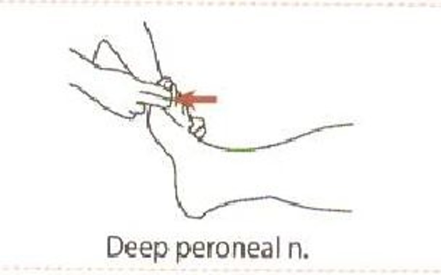 <p>resisted great toe extension</p>