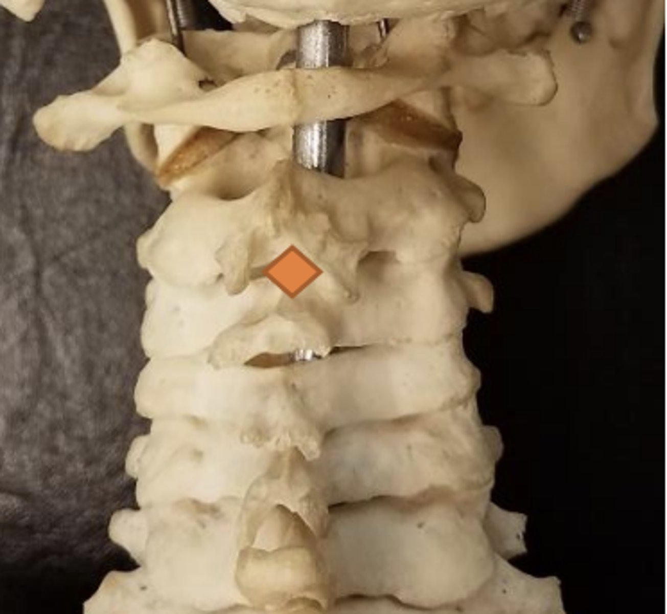 <p>inferior aspect of spinous processes of C2</p>