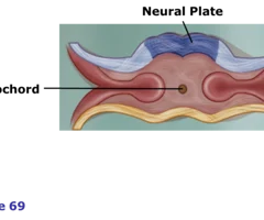 <p>the flattening of the neural ectoderm</p>