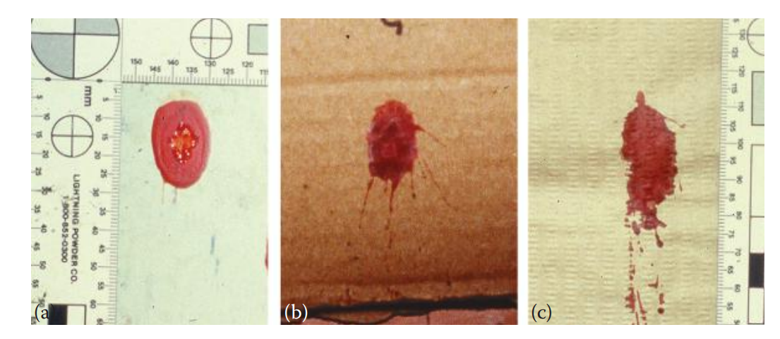The respective morphologies of falling blood drops that land on surfaces with different textures at a 30° angle. (a) Tile, (b) cardboard, and (c) paper towel.