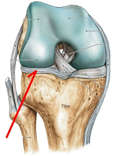 articulation between femoral and tibial condyles (hinge)