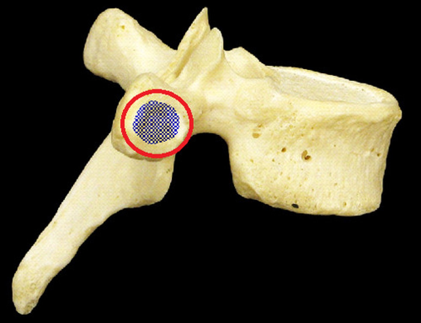 <p>Name the Boney Structure</p>