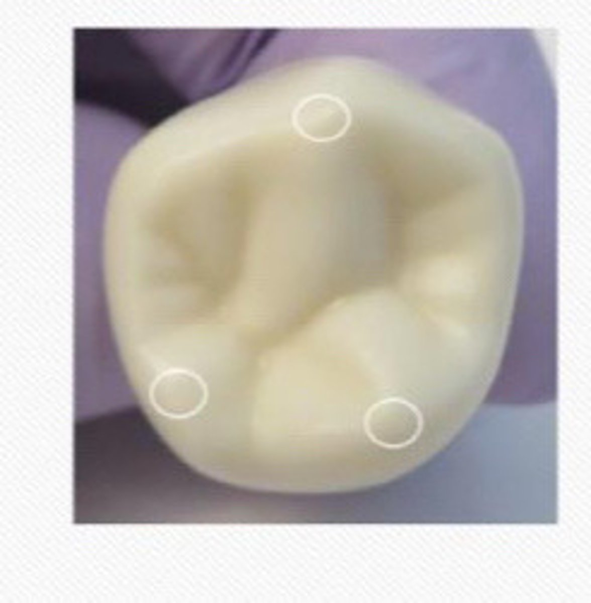 <p>__ with two lingual cusp</p>