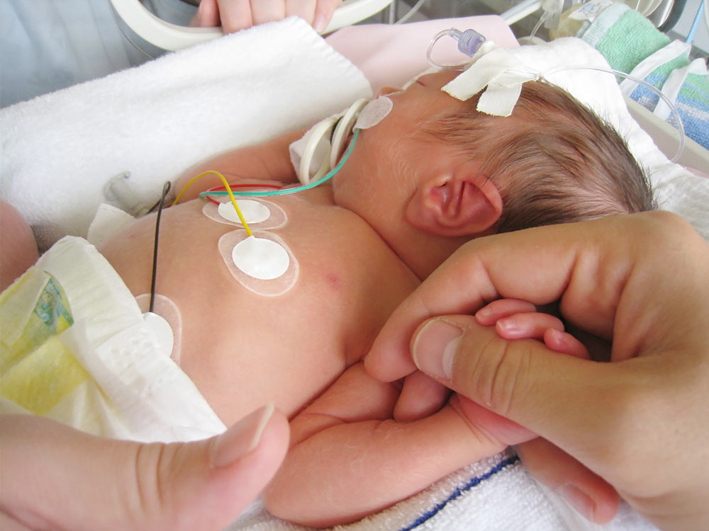 <p>Neonate (0-1month) HR</p>