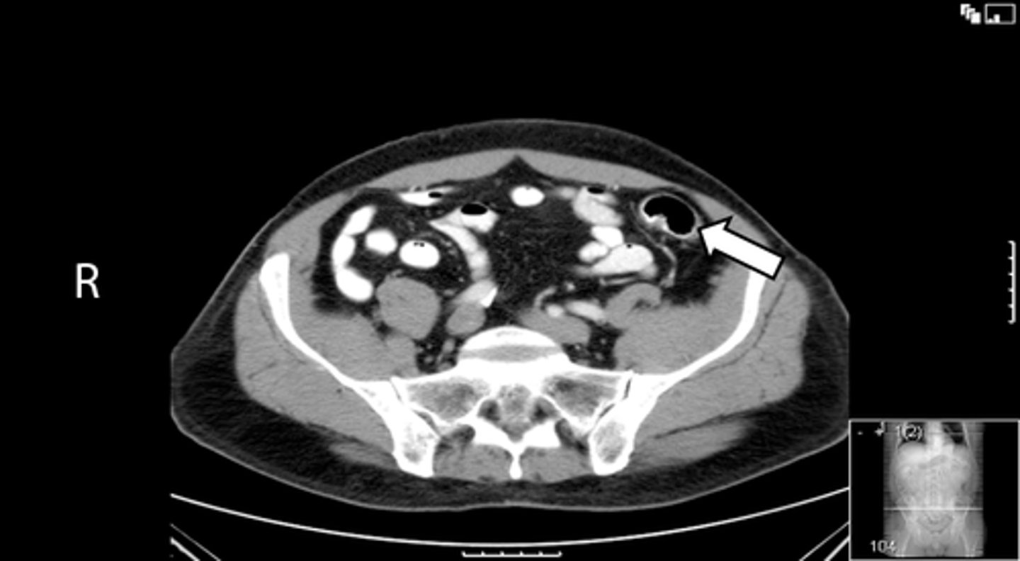 <p>What is indicated in the image?</p>