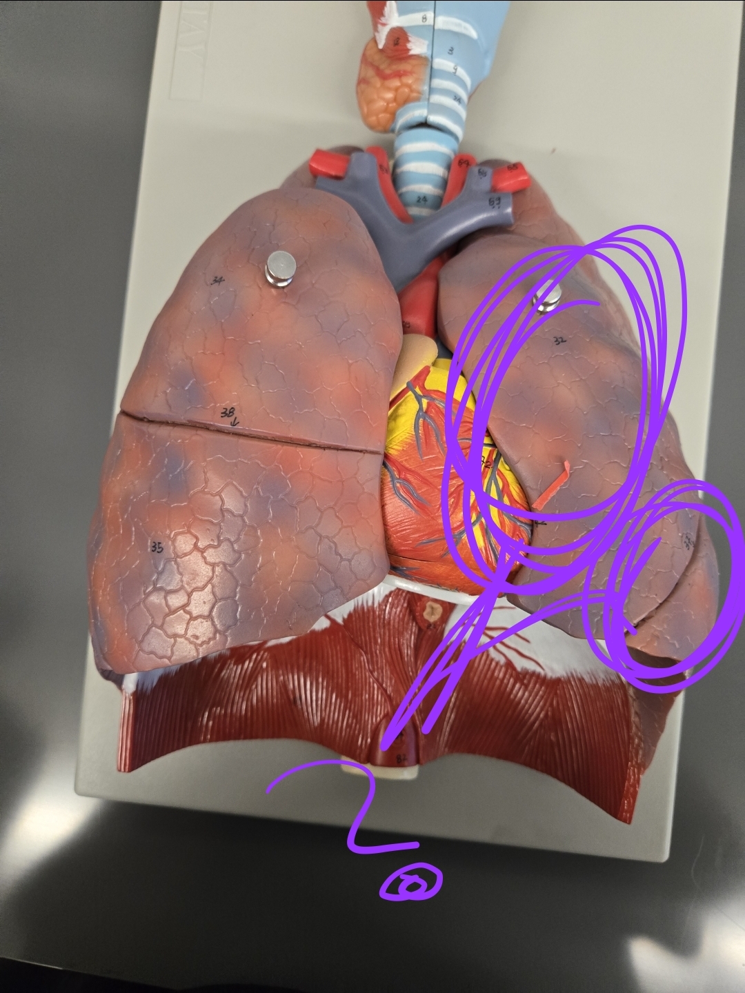 <p>Which side of the lung is this?</p>