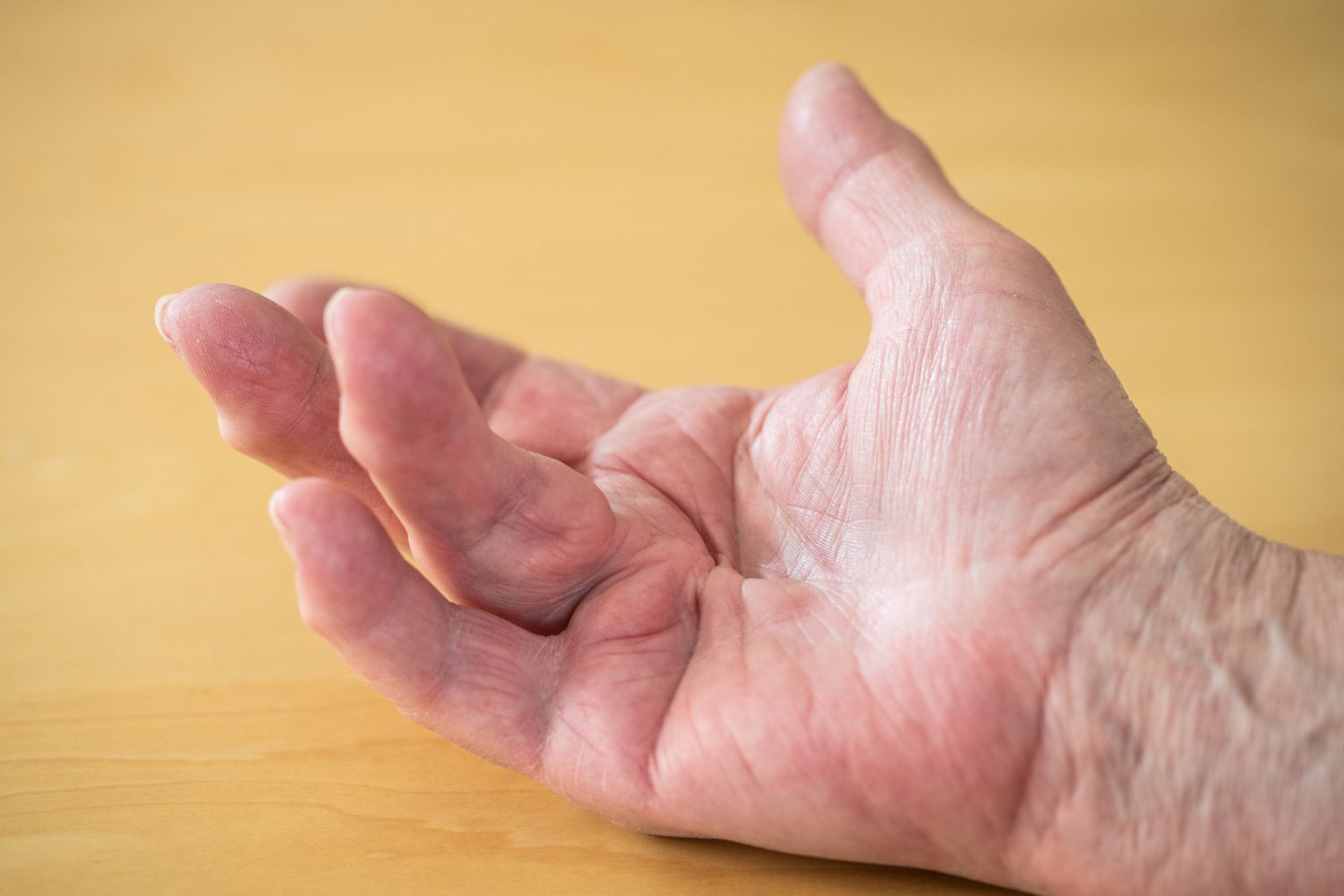<p>Contracture is the <strong>severe tightening of muscles that can result in the permanent bending of a joint.</strong> </p><ul><li><p>loss of reflexibility in muscles </p></li><li><p>can be used by chronic illness</p></li></ul><p></p>