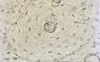 <p>Identifica el tejido</p>