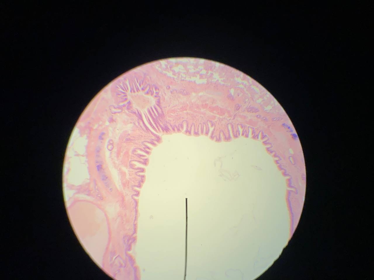 term image