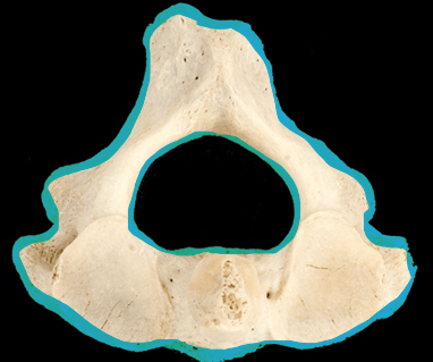 <p>name the bone</p>