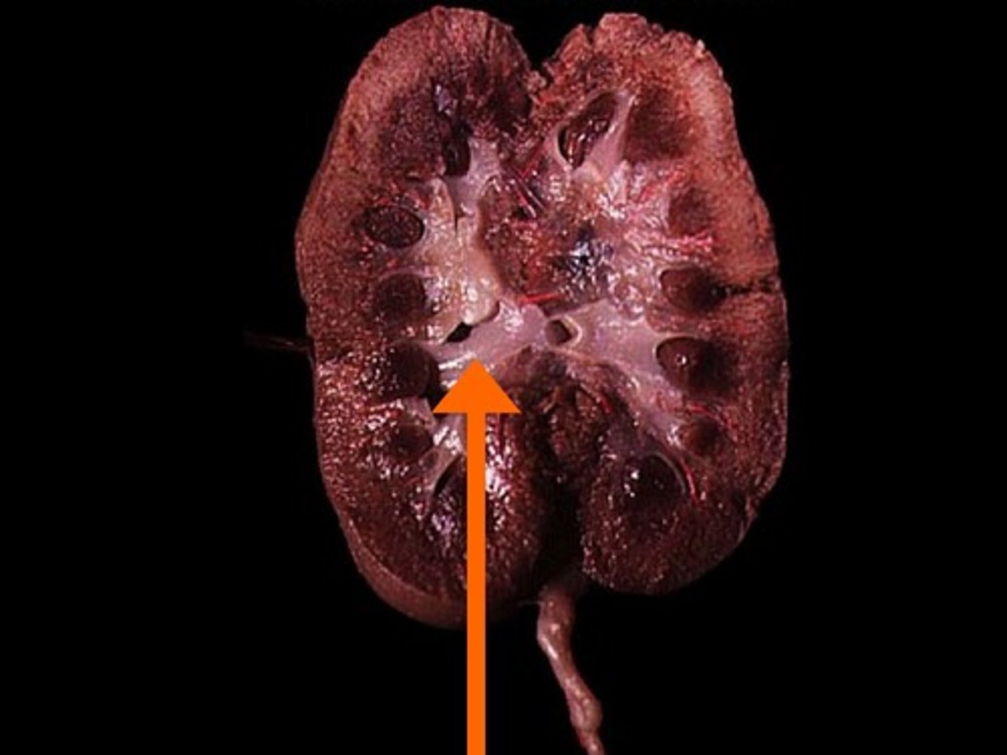 <p>Places where major calyces converge, portion of the kidney that narrows to become the ureter.</p>