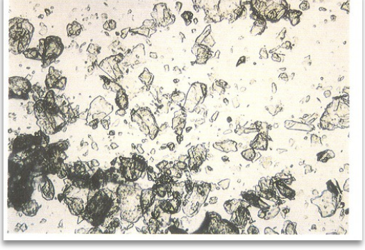 <ul><li><p class="">Appears as flat sheets</p></li><li><p class="">May be confused with cholesterol or other crystals</p></li></ul><p></p>