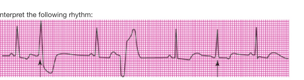 <p>interpret the rhythm</p>