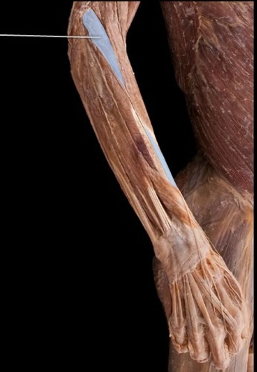 <p>What muscle is this?</p>