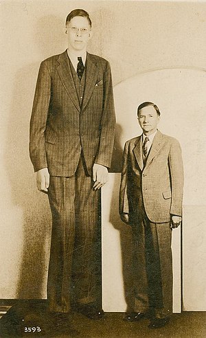 gigantism 