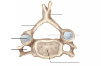 <p>what vertebrae type is this ?</p>