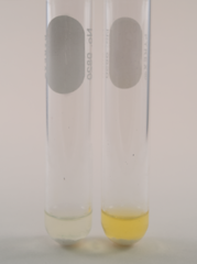 <p>ONPG interpretation</p>