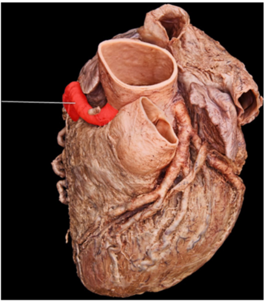 <p>right coronary artery</p>