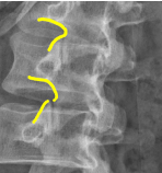<p>Q what is the name of this measurement? and what is the average + range?</p>