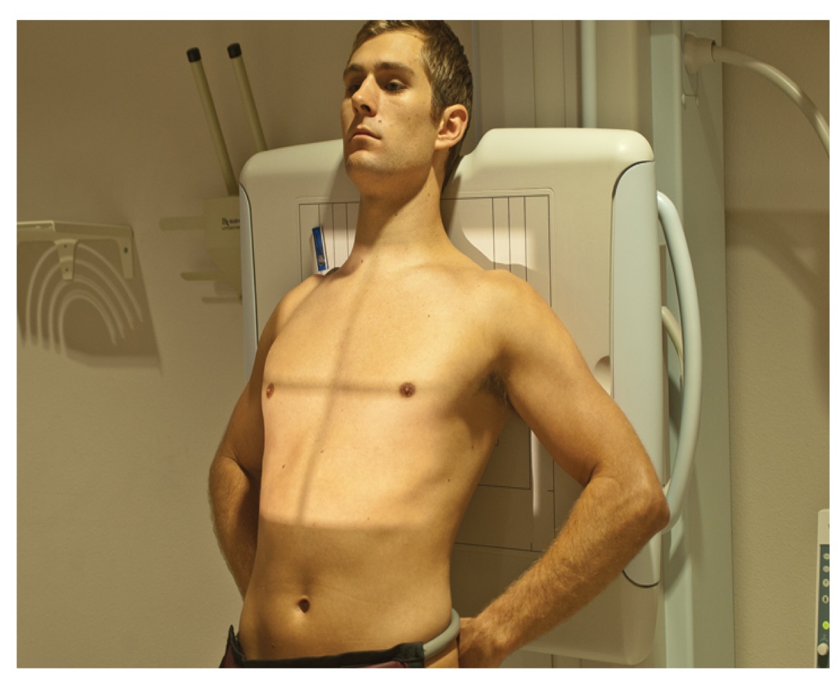 <p>AP chest view with patient leaning back to project clavicles above lungs; assesses apical regions.</p>