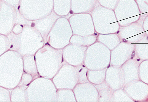 <p>what type of connective tissue cell is seen in this picture?</p>