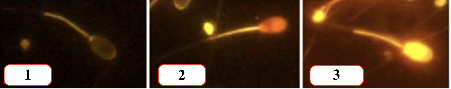 <p>Phát biểu nào sau đây là đúng về tinh trùng trong hình trên ?</p><ul><li><p>a. Tinh trùng sống</p></li><li><p>b. Tinh trùng chết</p></li></ul><p>A. 1a, 2b, 3a</p><p>B. 1b, 2b, 3a</p><p>C. 1a, 2b, 3a</p><p>D. 1a, 2b, 3b</p>