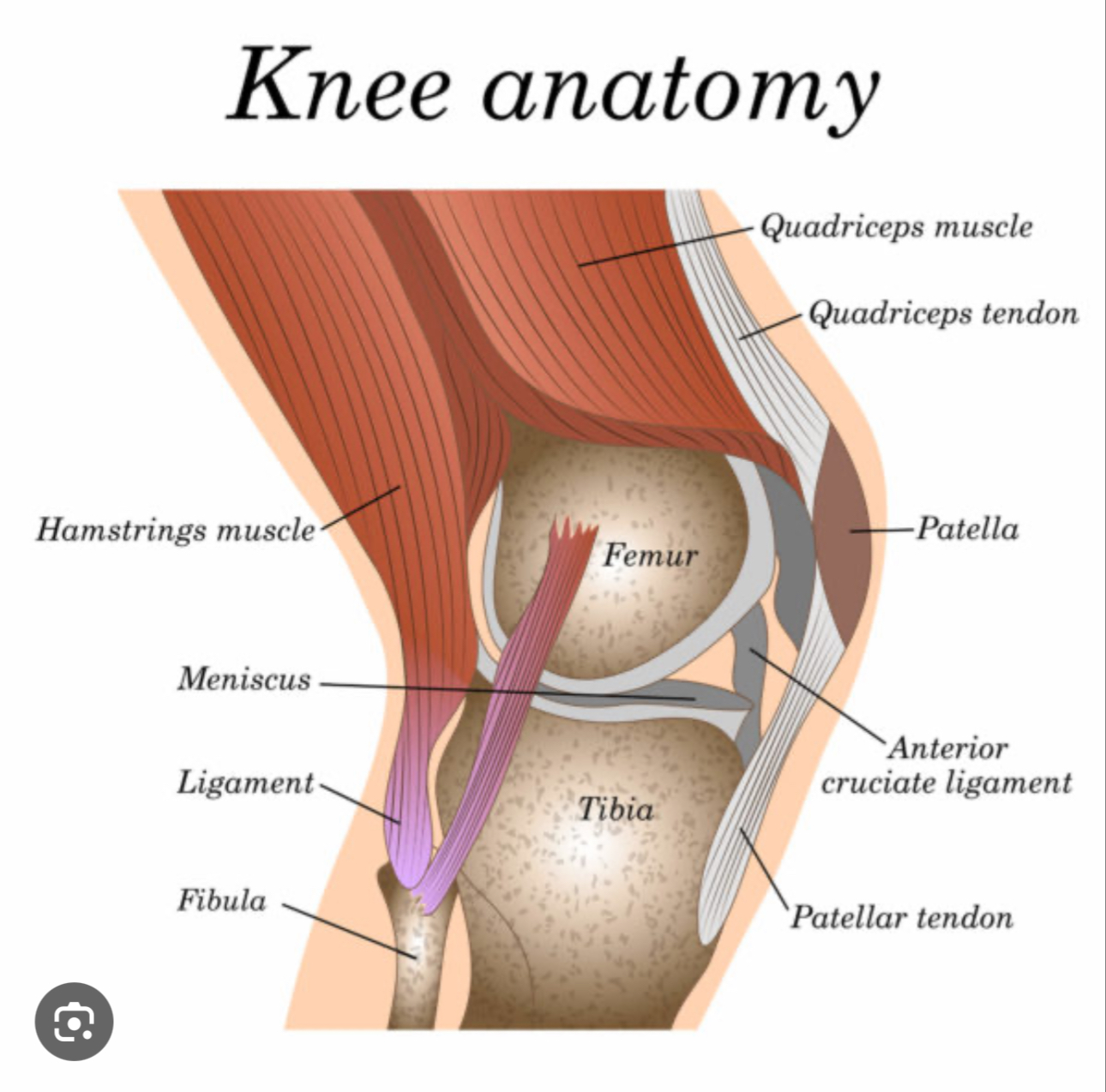 <p>Patella</p><p></p><p></p><p></p><p></p>