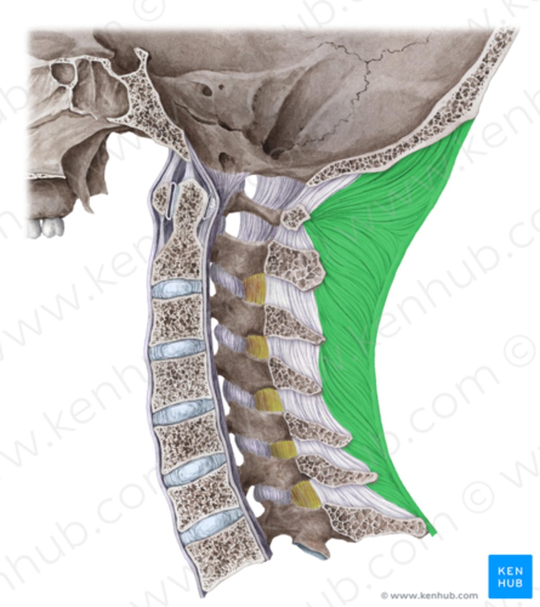 <p>Nuchal Ligament</p>