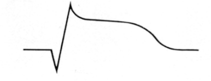 ST segment elevation in the affected leads, which can be visible for up to one week after the infarction.
