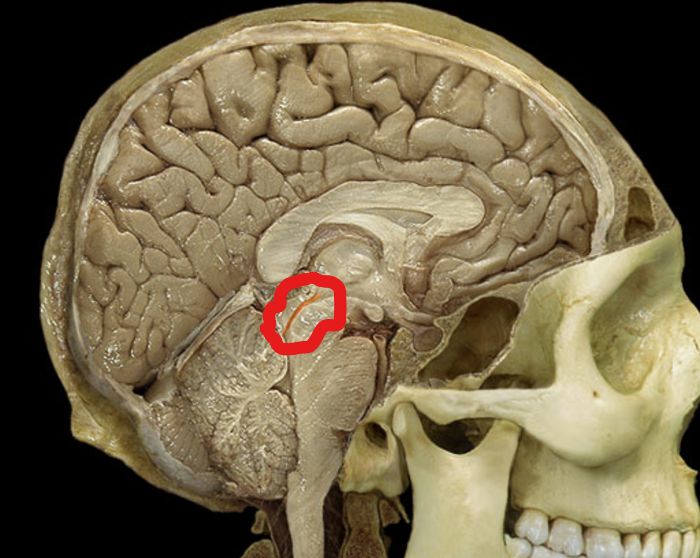 term image