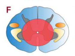 <p>Describe the effects of the lesion</p>