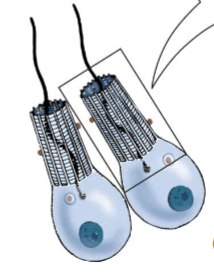 <p>What are these?</p>