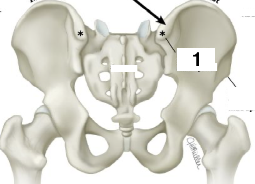 <p>What structure is 1 pointing to?</p>