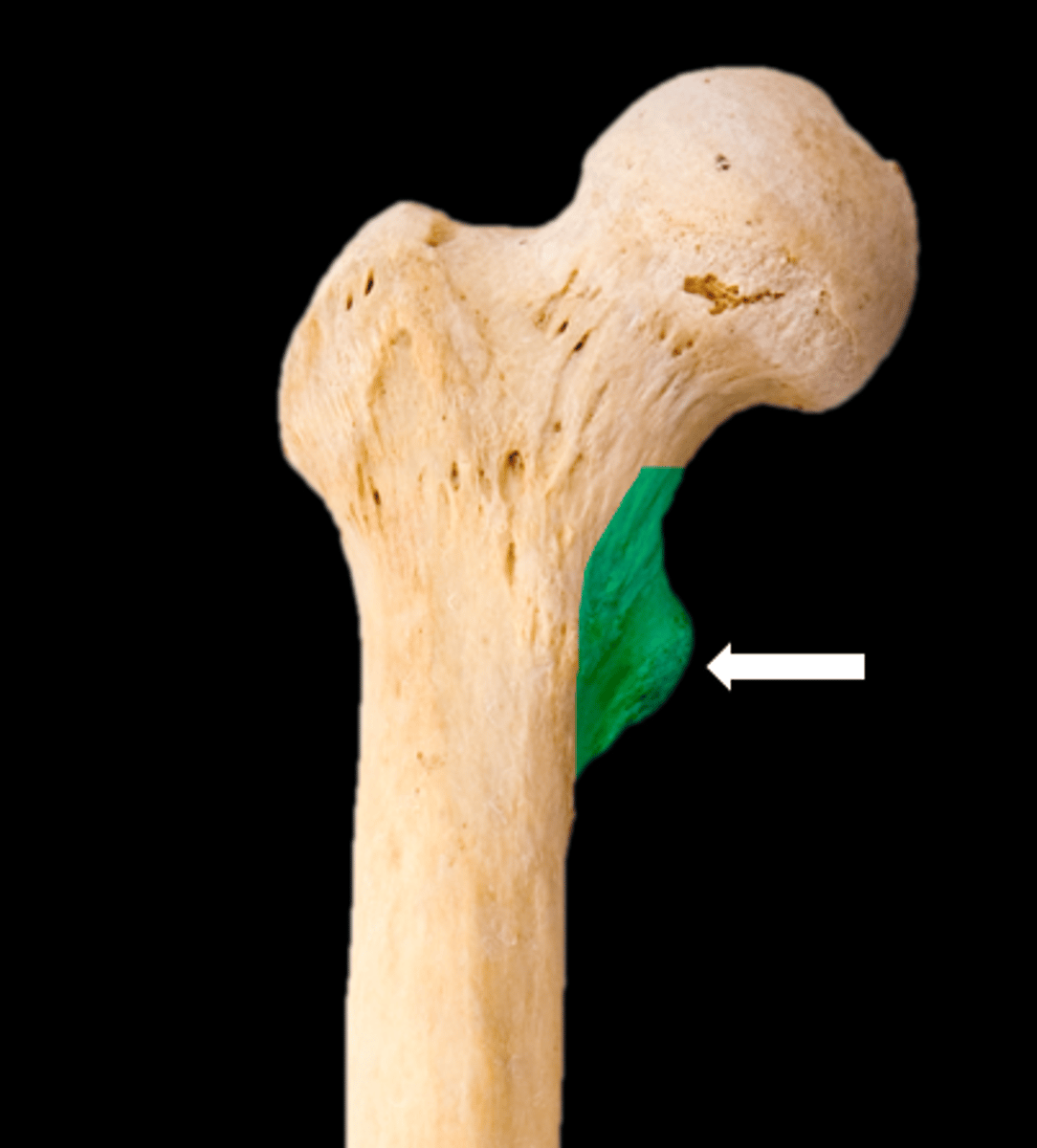 <p>name the part</p>